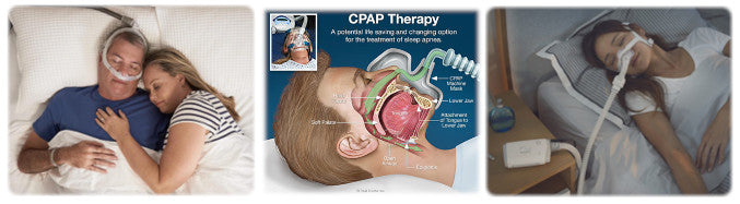 Cpap Fio2 Osa How to treat OSA? – cpaphub.ca